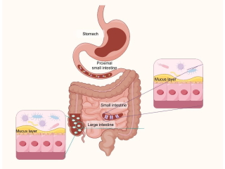 Irritabel tyktarm (IBS)